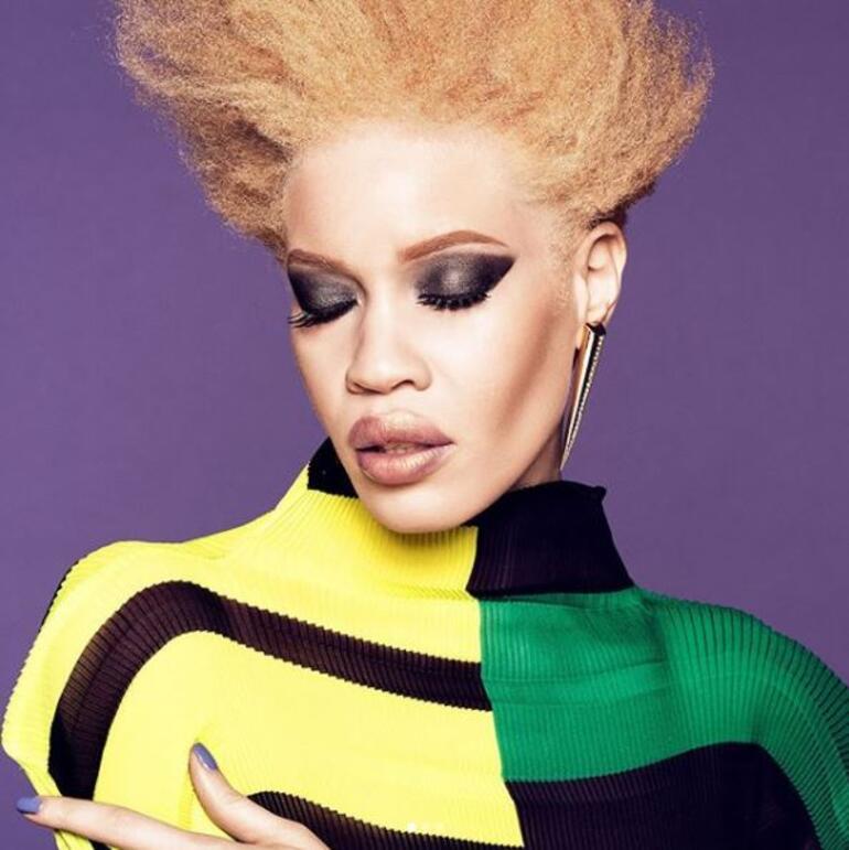 Dünyada bir ilk: Albino model makyaj markasının yüzü oldu