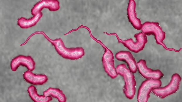 Güney Sudan'da kolera salgını
