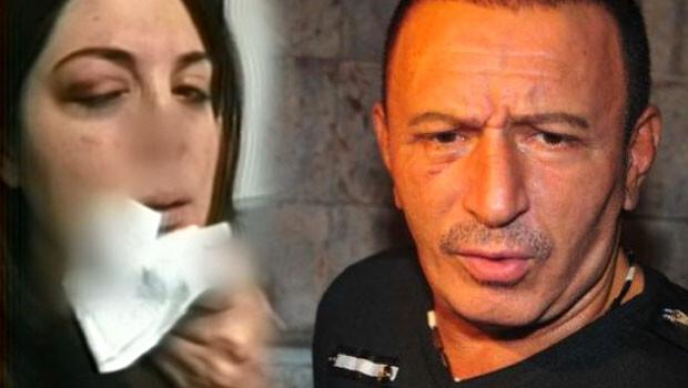 Mustafa Topaloğlu eşi Derya Topaloğluna şiddet mi uyguladı