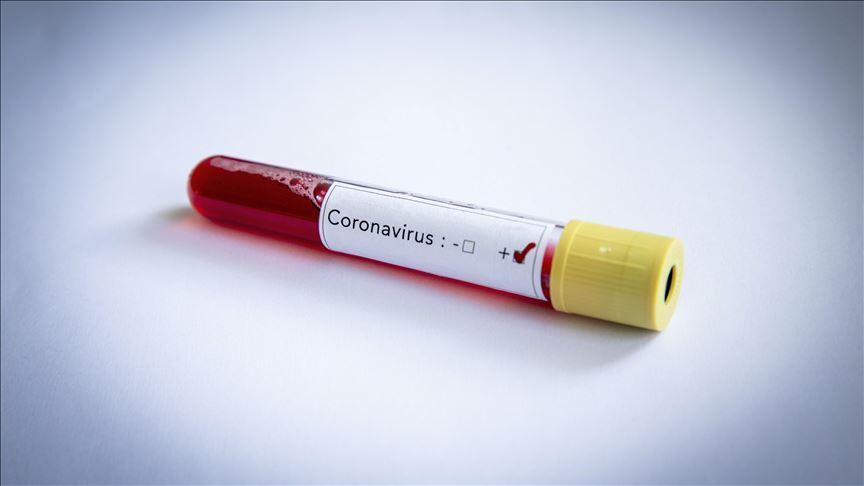 Ruling AKP lawmaker tests positive for coronavirus ...