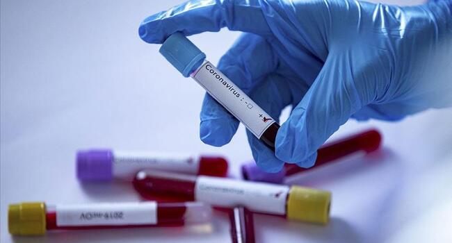 Turkey ramps up virus measures as confirmed cases reach 47