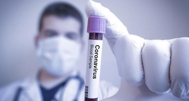Turkeys coronavirus death toll up seven to 44, with 343 new cases
