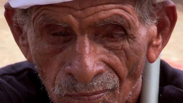 Genetik bozukluk Yemende bir kÃ¶yÃ¼ kÃ¶r etti