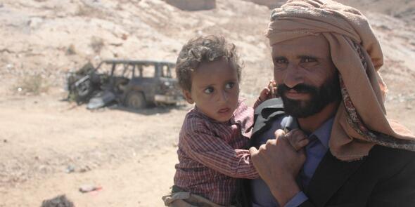 Genetik bozukluk Yemende bir kÃ¶yÃ¼ kÃ¶r etti